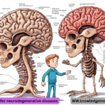 GLP 1s for neurodegenerative diseases